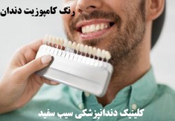 روشن ترين رنگ كامپوزيت چه رنگى است؟